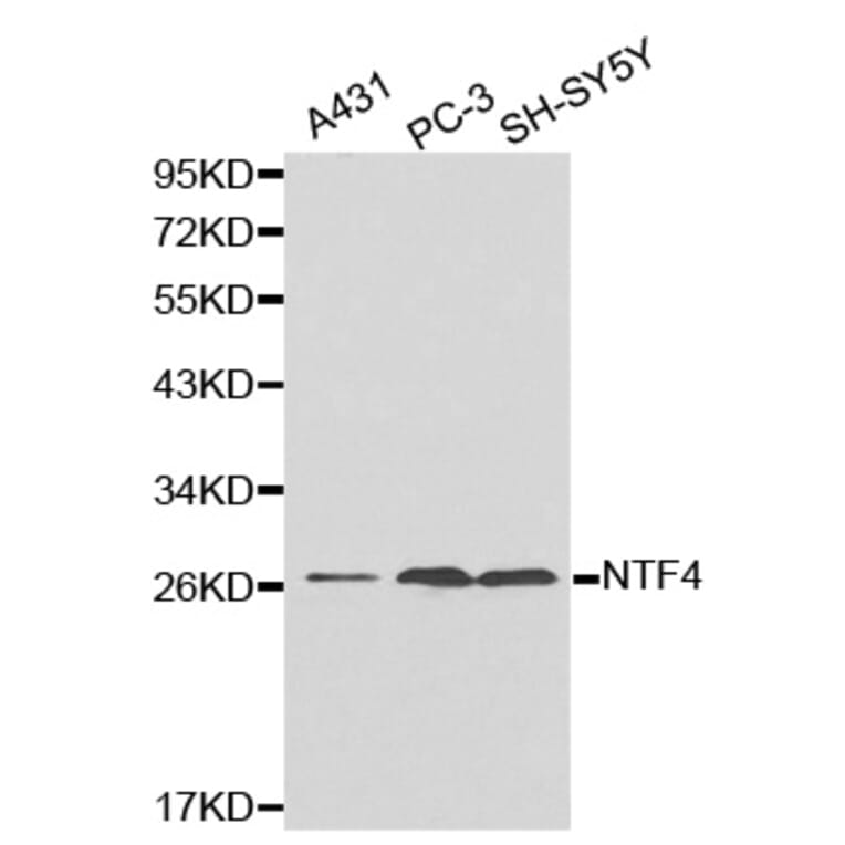 Western blot - NTF4 antibody from Signalway Antibody (38180) - Antibodies.com