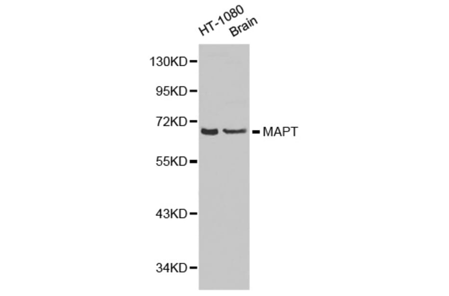 Western blot - MAPT antibody from Signalway Antibody (38187) - Antibodies.com