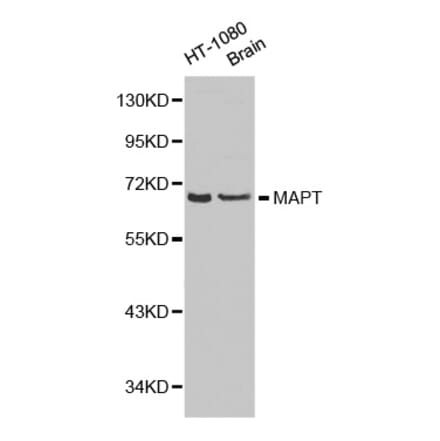 Western blot - MAPT antibody from Signalway Antibody (38187) - Antibodies.com
