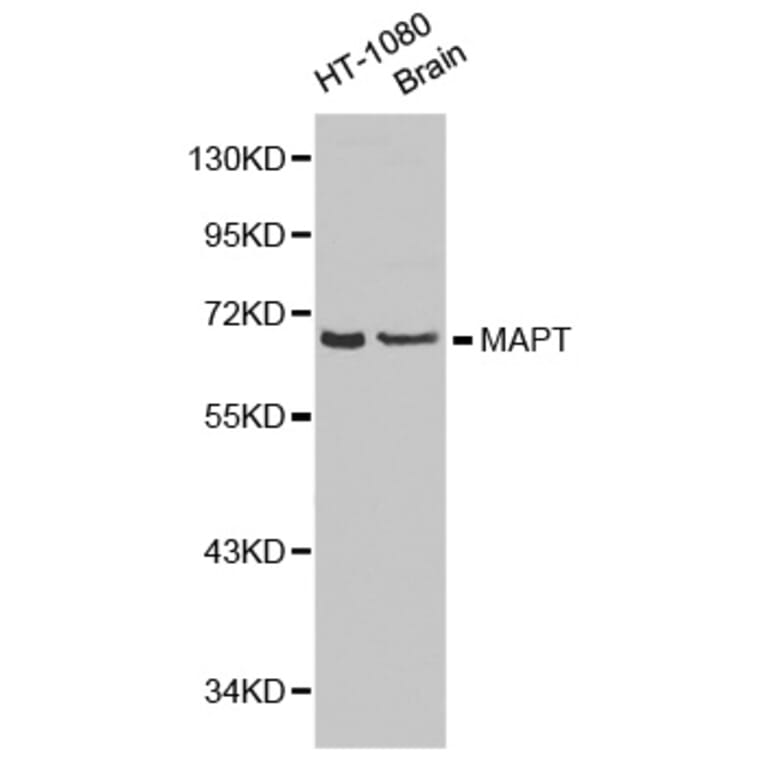 Western blot - MAPT antibody from Signalway Antibody (38187) - Antibodies.com