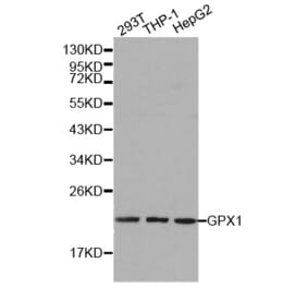 Western blot - GPX1 antibody from Signalway Antibody (38188) - Antibodies.com