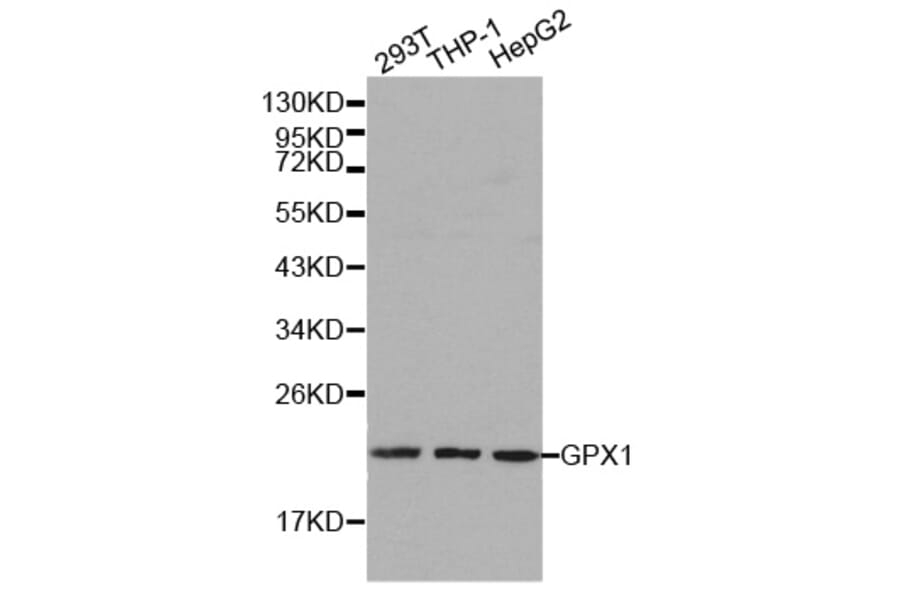 Western blot - GPX1 antibody from Signalway Antibody (38188) - Antibodies.com