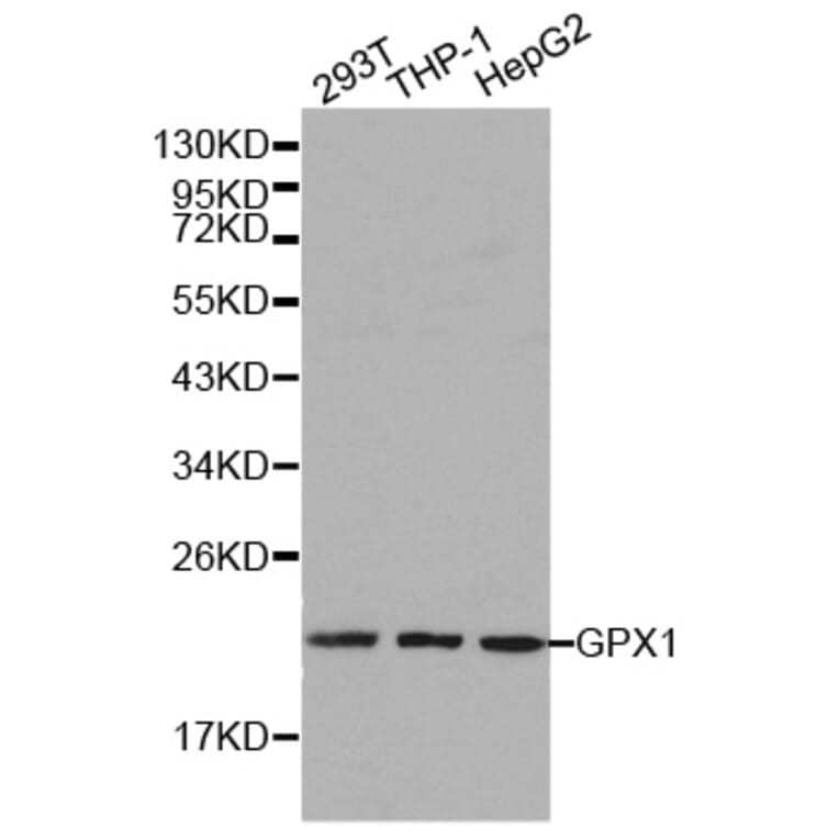 Western blot - GPX1 antibody from Signalway Antibody (38188) - Antibodies.com