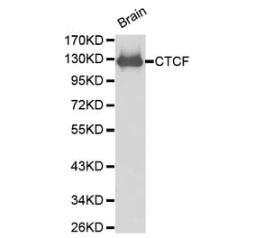 Western blot - CTCF antibody from Signalway Antibody (38199) - Antibodies.com