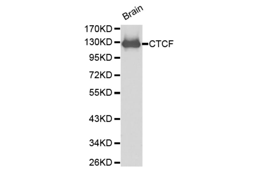 Western blot - CTCF antibody from Signalway Antibody (38199) - Antibodies.com