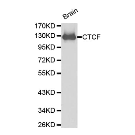 Western blot - CTCF antibody from Signalway Antibody (38199) - Antibodies.com
