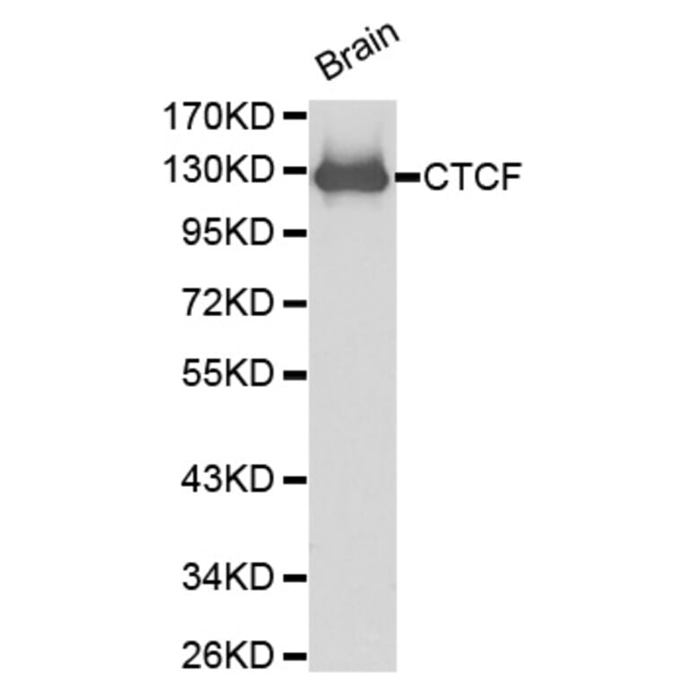 Western blot - CTCF antibody from Signalway Antibody (38199) - Antibodies.com