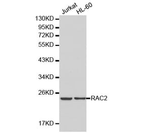 Western blot - RAC2 antibody from Signalway Antibody (38201) - Antibodies.com