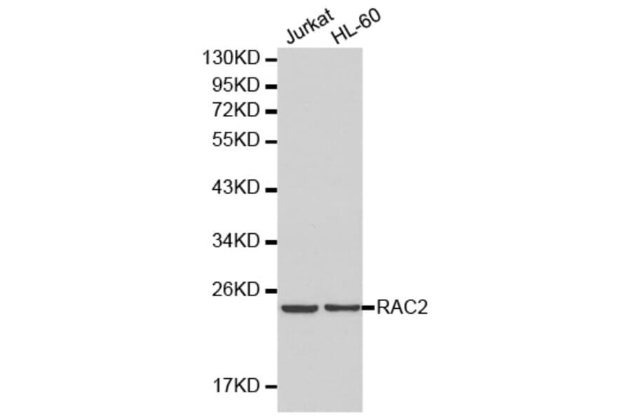 Western blot - RAC2 antibody from Signalway Antibody (38201) - Antibodies.com