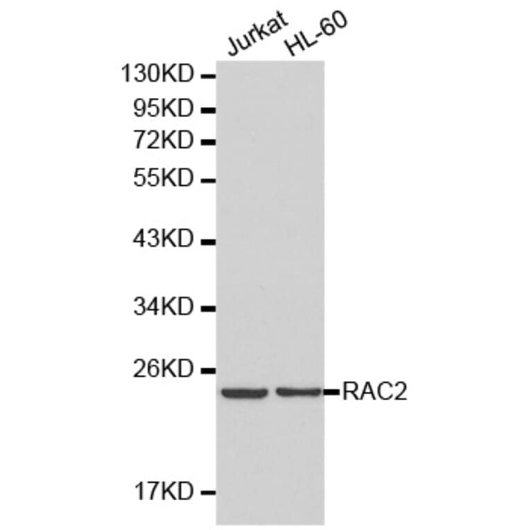 Western blot - RAC2 antibody from Signalway Antibody (38201) - Antibodies.com