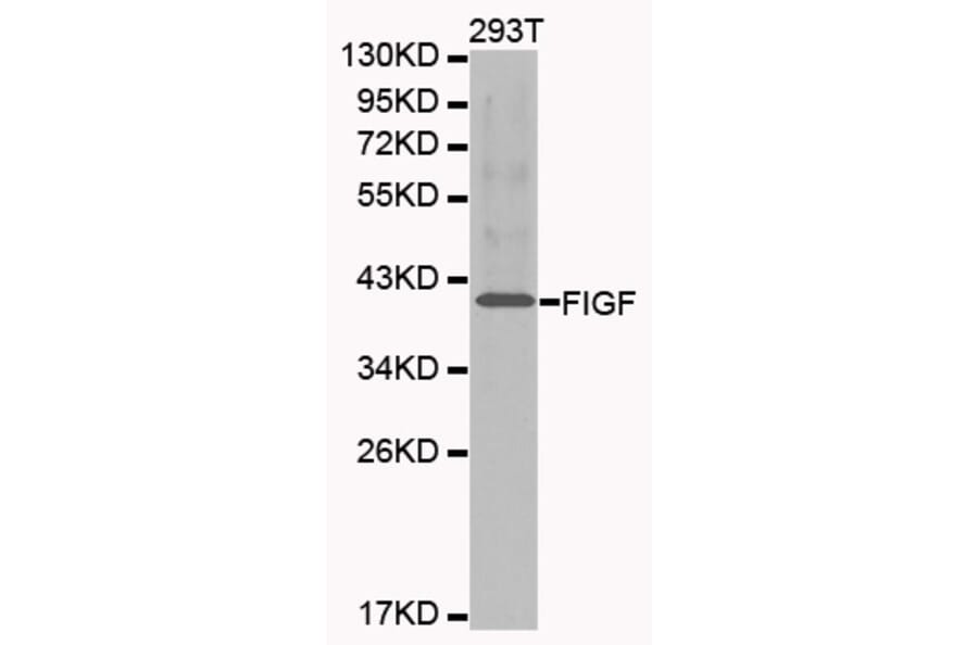 Western blot - FIGF antibody from Signalway Antibody (38213) - Antibodies.com