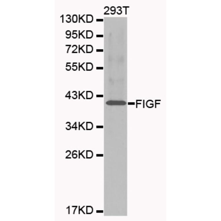 Western blot - FIGF antibody from Signalway Antibody (38213) - Antibodies.com