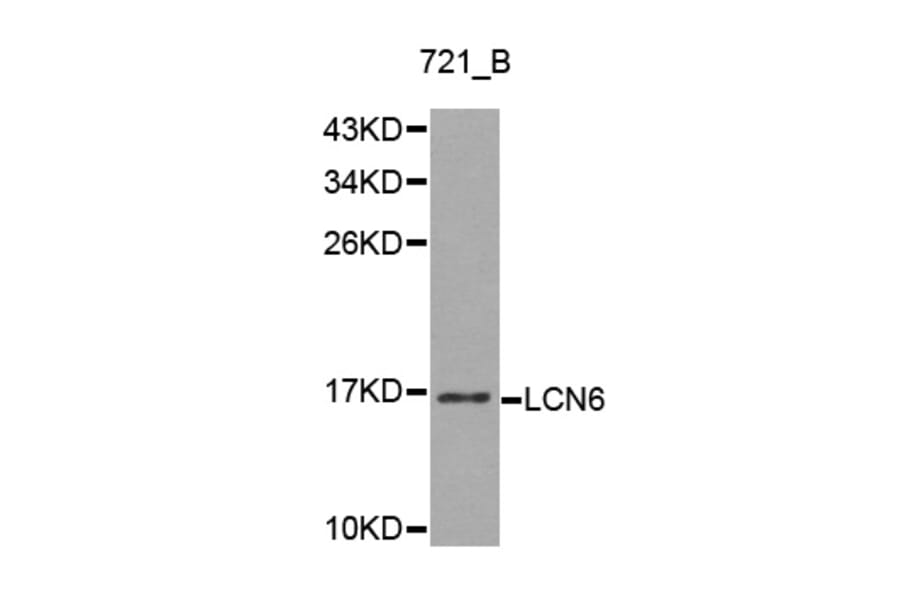 Western blot - LCN6 antibody from Signalway Antibody (38214) - Antibodies.com