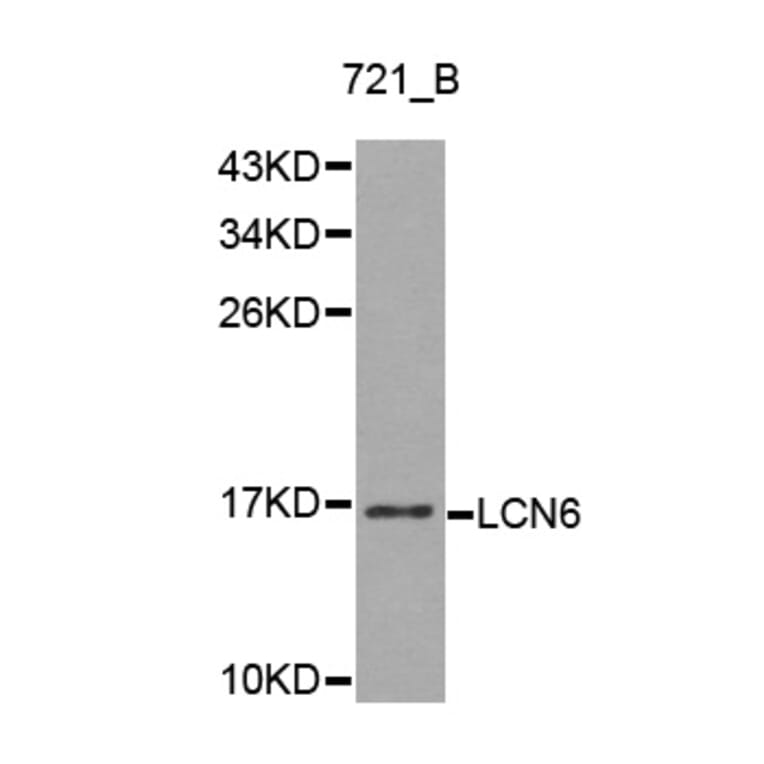 Western blot - LCN6 antibody from Signalway Antibody (38214) - Antibodies.com