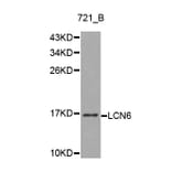 Western blot - LCN6 antibody from Signalway Antibody (38214) - Antibodies.com