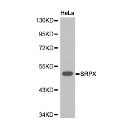 Western blot - SRPX antibody from Signalway Antibody (38219) - Antibodies.com