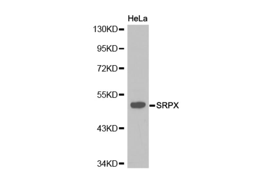 Western blot - SRPX antibody from Signalway Antibody (38219) - Antibodies.com