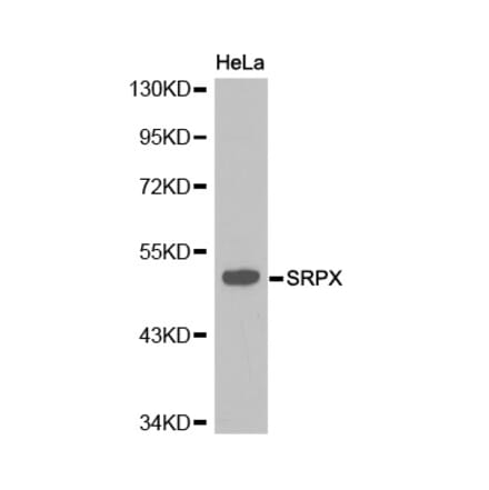 Western blot - SRPX antibody from Signalway Antibody (38219) - Antibodies.com
