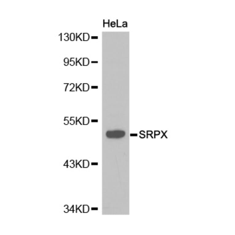 Western blot - SRPX antibody from Signalway Antibody (38219) - Antibodies.com