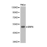 Western blot - SRPX antibody from Signalway Antibody (38219) - Antibodies.com