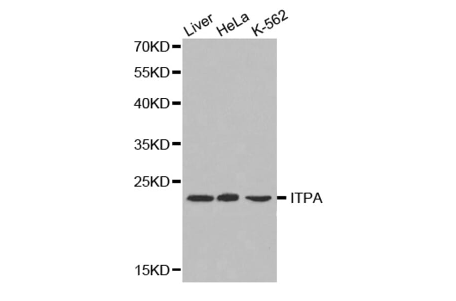 Western blot - ITPA antibody from Signalway Antibody (38220) - Antibodies.com
