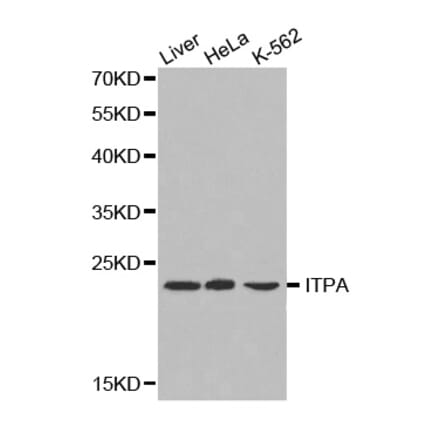 Western blot - ITPA antibody from Signalway Antibody (38220) - Antibodies.com