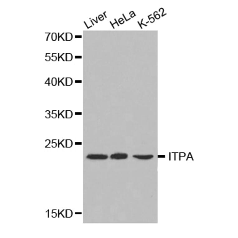 Western blot - ITPA antibody from Signalway Antibody (38220) - Antibodies.com