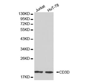 Western blot - CD3D antibody from Signalway Antibody (38225) - Antibodies.com