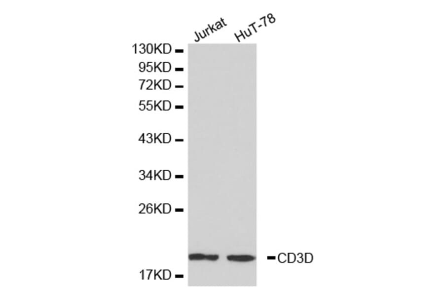 Western blot - CD3D antibody from Signalway Antibody (38225) - Antibodies.com