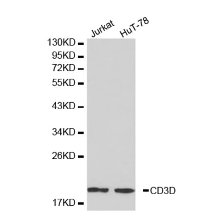 Western blot - CD3D antibody from Signalway Antibody (38225) - Antibodies.com