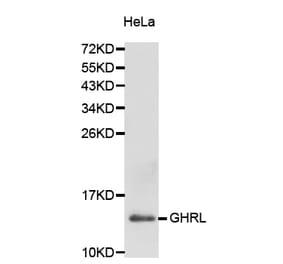 Western blot - GHRL antibody from Signalway Antibody (38229) - Antibodies.com