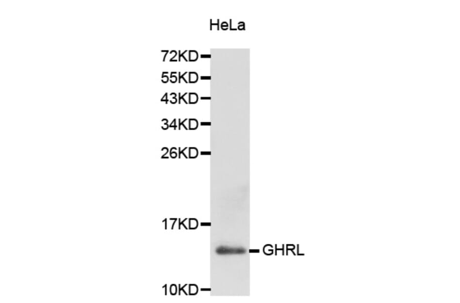 Western blot - GHRL antibody from Signalway Antibody (38229) - Antibodies.com