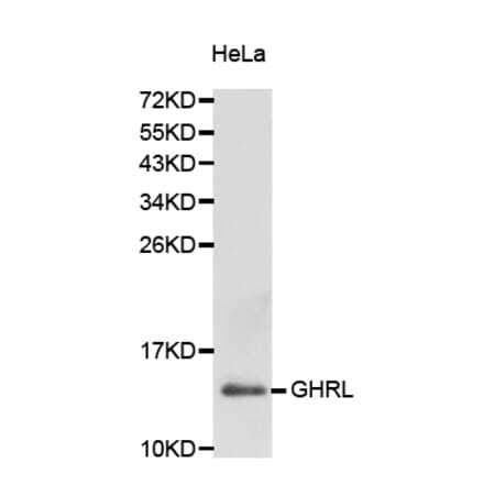 Western blot - GHRL antibody from Signalway Antibody (38229) - Antibodies.com
