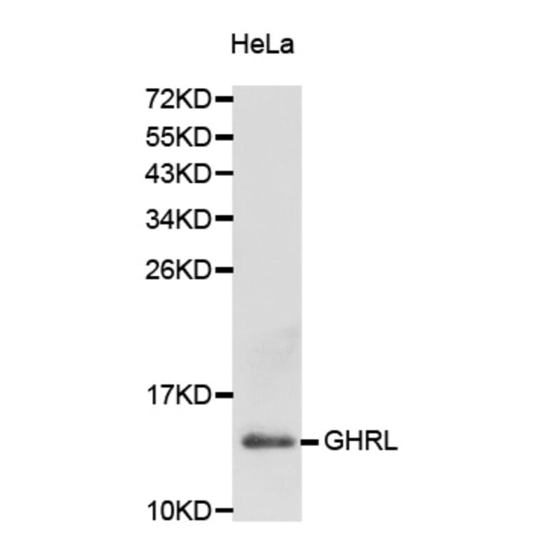 Western blot - GHRL antibody from Signalway Antibody (38229) - Antibodies.com