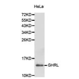 Western blot - GHRL antibody from Signalway Antibody (38229) - Antibodies.com