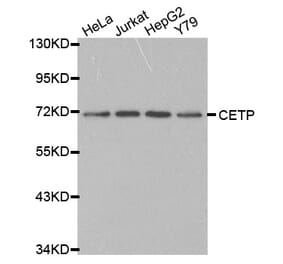 Western blot - CETP antibody from Signalway Antibody (38230) - Antibodies.com