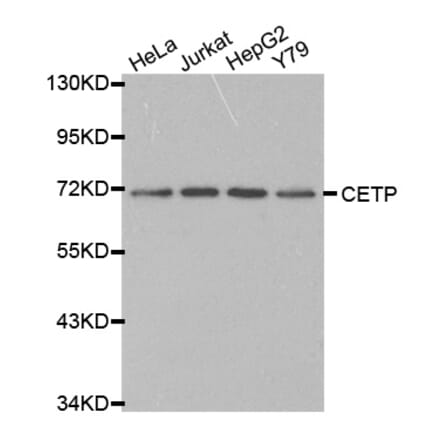 Western blot - CETP antibody from Signalway Antibody (38230) - Antibodies.com