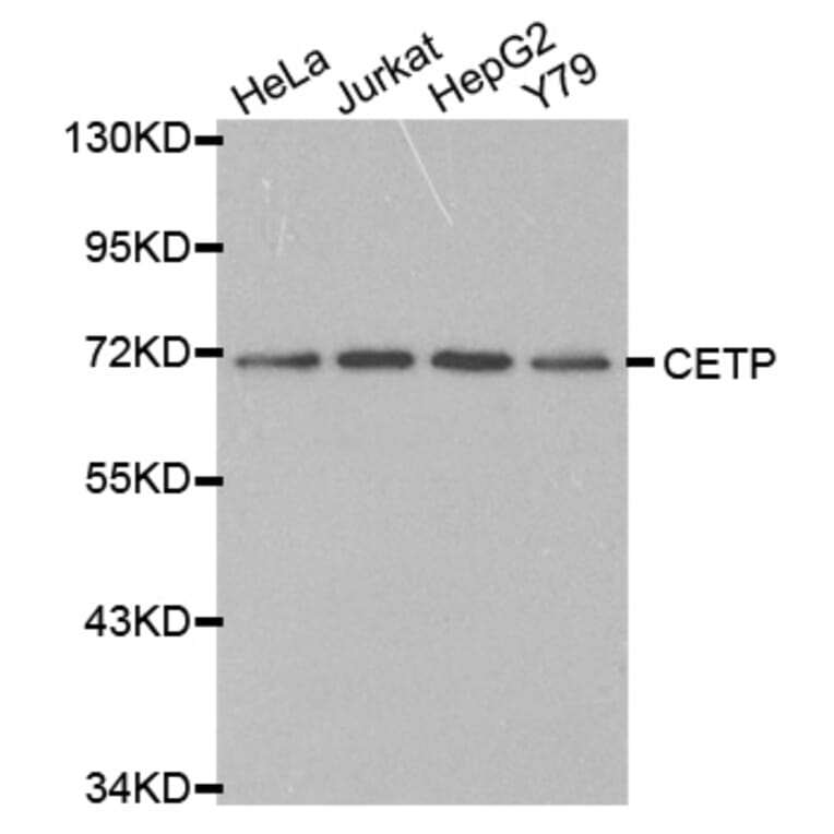 Western blot - CETP antibody from Signalway Antibody (38230) - Antibodies.com