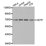 Western blot - CETP antibody from Signalway Antibody (38230) - Antibodies.com