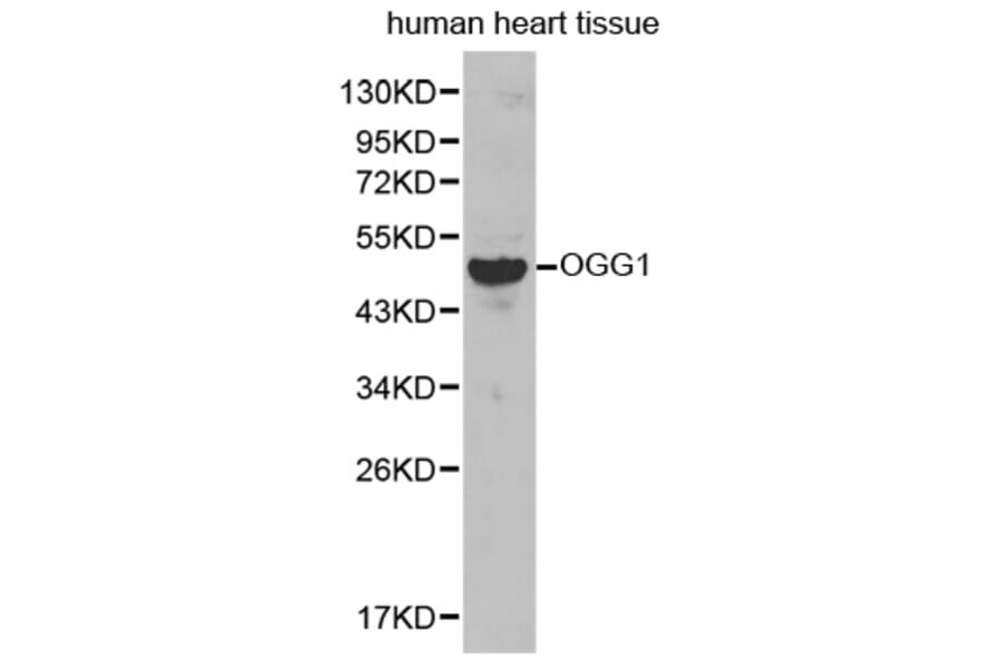 Western blot - OGG1 antibody from Signalway Antibody (38236) - Antibodies.com