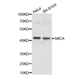 Western blot - MICA antibody from Signalway Antibody (38237) - Antibodies.com