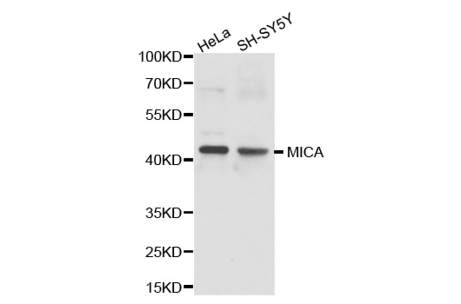 Western blot - MICA antibody from Signalway Antibody (38237) - Antibodies.com