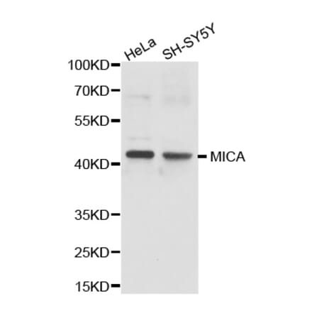 Western blot - MICA antibody from Signalway Antibody (38237) - Antibodies.com