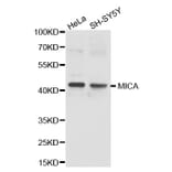 Western blot - MICA antibody from Signalway Antibody (38237) - Antibodies.com