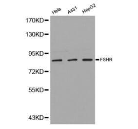 Western blot - FSHR antibody from Signalway Antibody (38242) - Antibodies.com