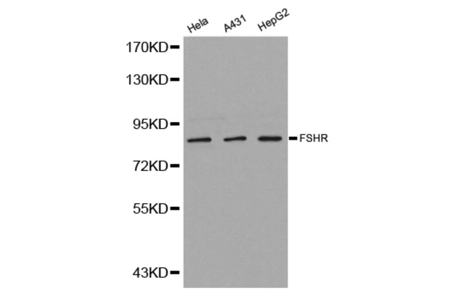 Western blot - FSHR antibody from Signalway Antibody (38242) - Antibodies.com