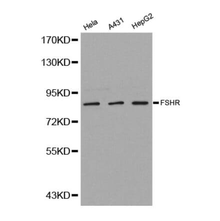Western blot - FSHR antibody from Signalway Antibody (38242) - Antibodies.com