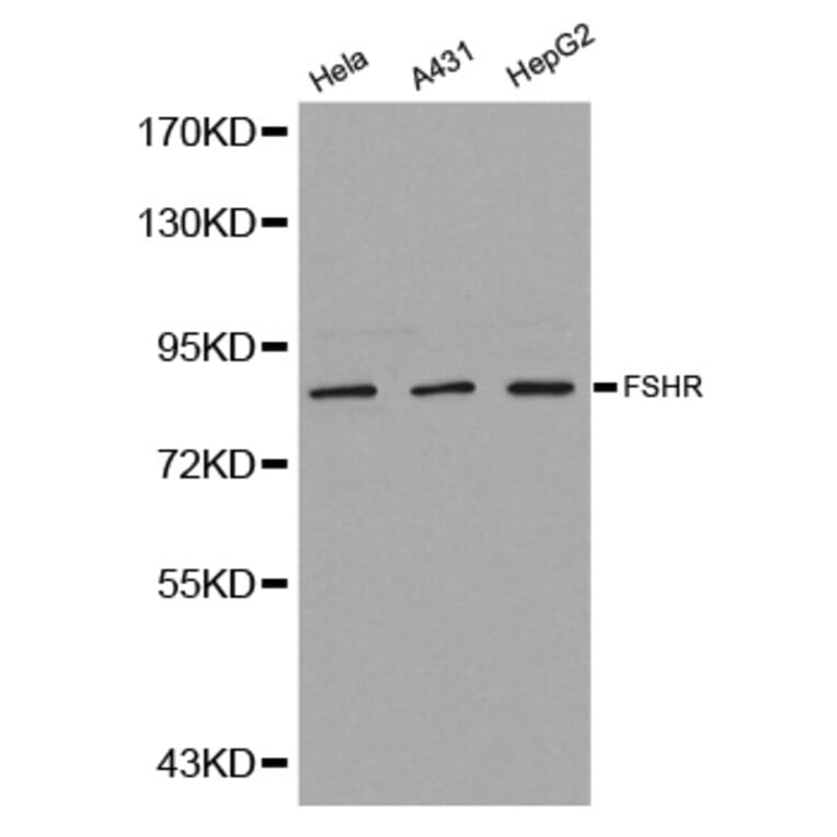 Western blot - FSHR antibody from Signalway Antibody (38242) - Antibodies.com