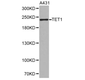Western blot - TET1 antibody from Signalway Antibody (38243) - Antibodies.com