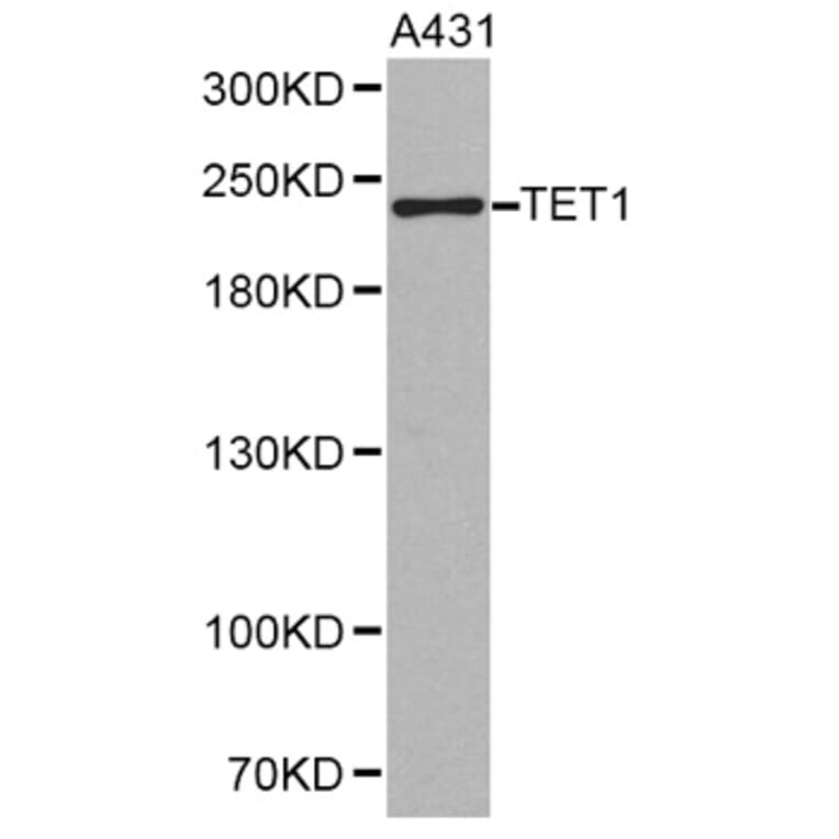 Western blot - TET1 antibody from Signalway Antibody (38243) - Antibodies.com